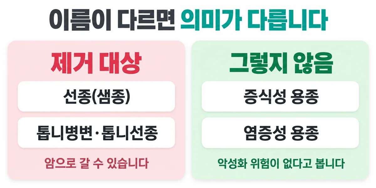 선종과 톱니병변은 제거 대상이고 증식성 용종과 염증성 용종은 악성화 위험이 없다는 비교