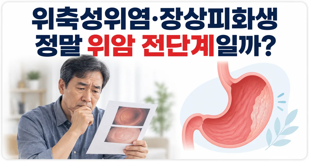 위내시경에서 발견되는 위축성위염과 장상피화생이 정말 위암 전단계인지 묻는 안내 이미지