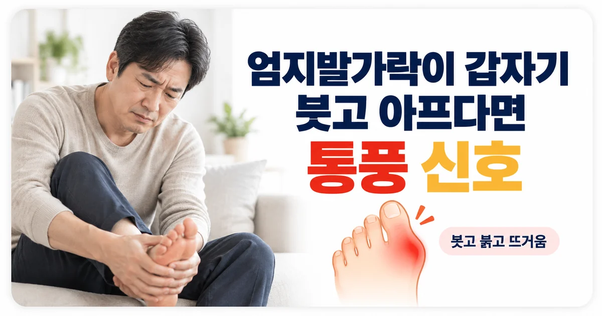 엄지발가락이 갑자기 붓고 아프다면 통풍 신호일 수 있다며 붉게 표시된 엄지발가락을 보여주는 안내 이미지